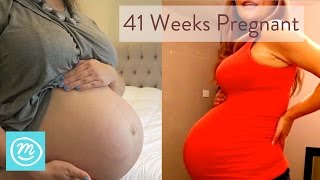 41 Weeks Pregnant: What You Need To Know - Channel Mum