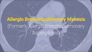 Allergic Bronchopulmonary Aspergillosis