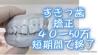 288)すきっ歯 費用安い 高校生 出っ歯を抜歯しない白いワイヤー矯正  大宮 鈴木歯科医院