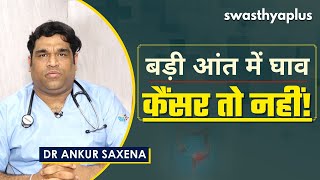 बड़ी आंत में घाव, कैंसर तो नहीं! | Colon Cancer (Colorectal Cancer)in Hindi | Dr Ankur Saxena