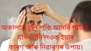 অকালতে চুলি পকি আমনি পাইছে যদি জানি লওক ইয়াৰ?কাৰণ আৰু নিৱাৰণৰ উপায়।@gharuadiha7587