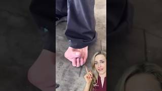 Doctor reacts: EXTREME bunion