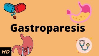 Gastroparesis, Causes, Signs and Symptoms, Diagnosis and Treatment.
