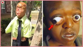 Horrifying Bizarre Appearances That Send Shivers Down the World's Spine