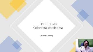 OSCE - Colorectal cancer