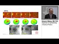 retina safety profile of subthreshold micropulse laser 810 nm vs 577 nm wavelength