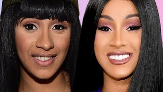 The Truth About Cardi B's DISASTROUS Plastic Surgery