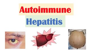Autoimmune Hepatitis | Pathogenesis, Signs & Symptoms, Diagnosis, Treatment