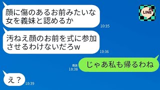 姉の結婚式で、顔に傷がある妹の私を蹴り飛ばして追い出した新郎「醜い顔の女は俺の式にはいらないw」→姉の一言で新郎が青ざめたwww