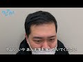 【 vlog】 美容クリニックの肌診断ってどんな感じ？【令和ロマン】