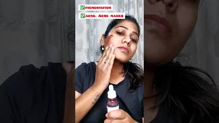 ✅️ആഴ്ചയിൽ ഒരിക്കൽ ചെയ്യാം Chemical Exfoliation fr pigmentation|Ordinary AHA30%BHA2% Peeling Solution