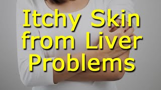 Itchy Skin from Liver Problems