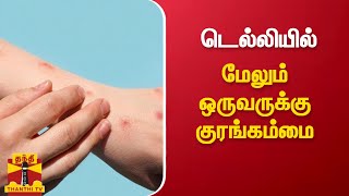 டெல்லியில் புதிதாக ஒருவருக்கு குரங்கம்மை பாதிப்பு