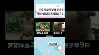 河南2歲女嬰肚大無比，酷似“懷孕”，手術現場嚇壞醫生，母親含淚揭開女兒身世 #家庭 #收養 #棄嬰 #先天疾病 #愛心 #正能量 #分享 #幸福人生 #第五情報站 #shorts