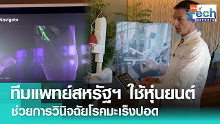 ทีมแพทย์สหรัฐฯ ใช้หุ่นยนต์เพื่อช่วยการวินิจฉัยโรคมะเร็งปอด | TNN Tech Reports