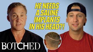 Mike Needs A Boob Implant in His HEAD to Fix A Hair Transplant Scar (Before & After) | Botched | E!