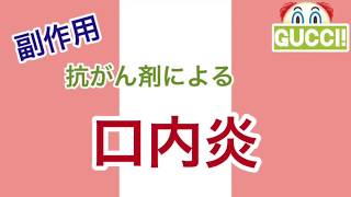 抗がん剤による口内炎について