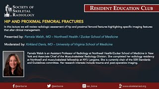 SSR Resident Education Club - Hip and Proximal Femoral Fractures