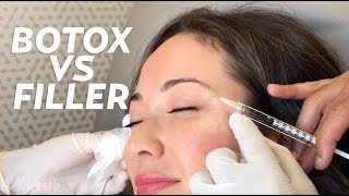 Botox vs Fillers: What's the Difference? | Beauty with Susan Yara