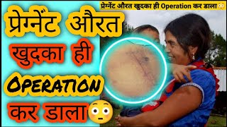 प्रेग्नेंट औरत खुदका ही Operation कर डाला😳 | Unexpected Self Operation #Shorts #Youtubeshorts