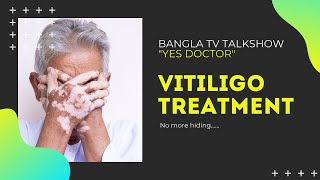 Vitiligo Treatment- Bangla TV talkshow