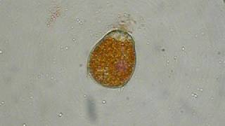 Allomyces Antheridium