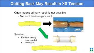 Step-by-Step Nerve Repair Webinar