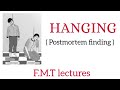 Hanging  ( Postmortem finding ) - F.M.T lectures for medical students