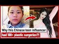 Why this Chinese teen influencer had 100+ plastic surgeries?!