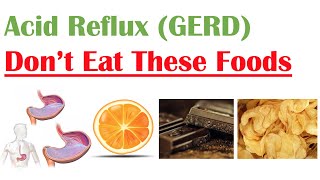 Worst Foods to Eat with Acid Reflux (GERD, Gastroesophageal Reflux Disease) | How to Reduce Symptoms