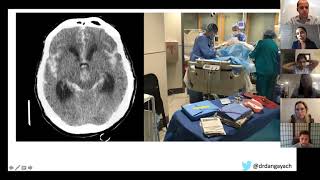 Medical Student Lecture Series - Neurocritical Care