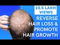 5 Easy Ways To Reverse Hair Loss & Promote Hair Growth