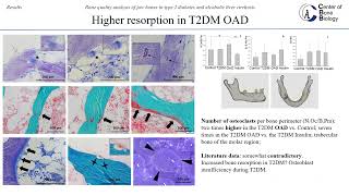 Doktorat Teodora Rodic - Bone quality analysis of jaw bones in type 2 diabetes and ...