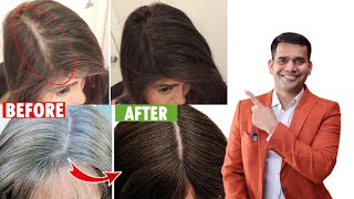 Stop Hair Fall And Reverse Premature Grey Hair Naturally - Dr. Vivek Joshi