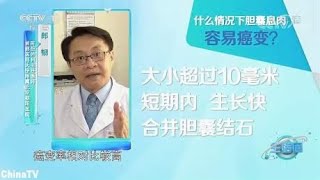 胆囊息肉会癌变吗？北京专家亲自为您讲解，这三种情况要注意！