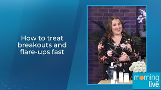 How to treat breakouts and flare-ups fast