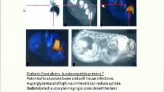 PET Scan in Orthopaedics