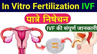 IVF | ivf procedure step by step | ivf process class 12 up board | In Vitro Fertilization | biology