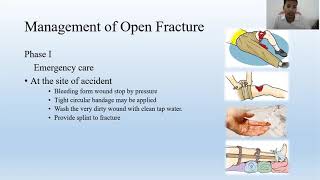 Management of Open Fracture