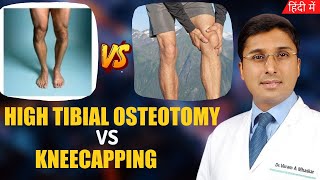 Difference Between High Tibial Osteotomy Vs Kneecapping | Hindi | Partial Knee Replacement Surgery