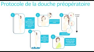 La douche préopératoire en pratique