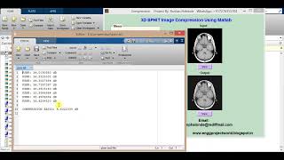 Image Compression Using SPHIT Algorithm Matlab Project With Source Code