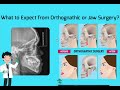 What to Expect from Orthognathic or Jaw Surgery Cases