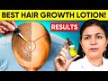 Best Hair Growth Lotion and Hair Loss Treatment for Men & Women