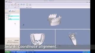 dental 3D Scannning-shining3d tech 3.0.mpg