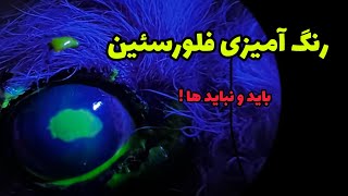 نکات کلینیکی، بخش پنجم - رنگ آمیزی فلورسئین (باید و نباید ها)