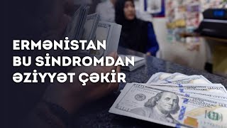 Ermənistan bu sindromdan əziyyət çəkir