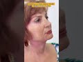 Înainte și după operația de lifting facial la clinica doctor levy din bucurești face lifting