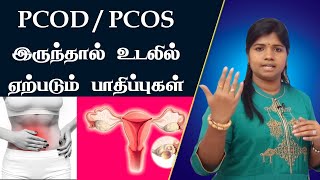 PCOD symptoms By  Dr. B.Yoga Vidhya (Ethnic Health Care )