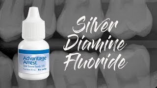 SILVER DIAMINE FLUORIDE for Incipient Caries \u0026 CHANNEL UPDATES